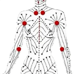 Drainage lymphatique
